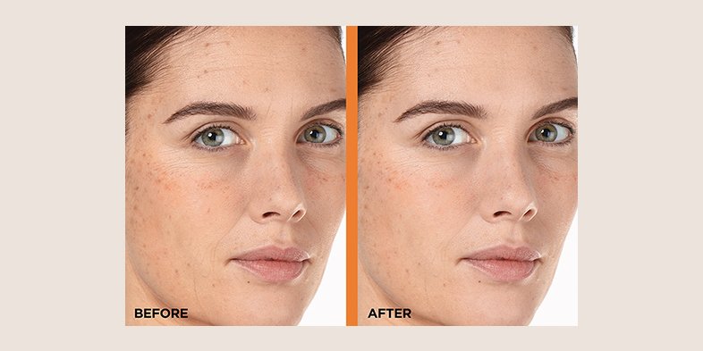 Inarticle Niacinamide And Vitamin C Revitalift12serum